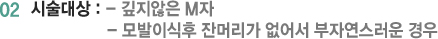 02 시술대상 : - 깊지않은 M자  - 모발이식후 잔머리가 없어서 부자연스러운 경우