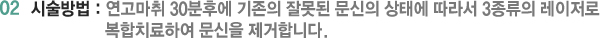 02 시술방법 : 연고마취 30분후에 기존의 잘못된 문신의 상태에 따라서 3종류의 레이저로 복합치료하여 문신을 제거합니다.