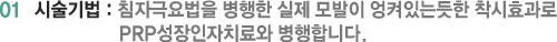 01 시술기법 : 침자극요법을 병행한 실제 모발이 엉켜있는듯한 착시효과로 PRP성장인자치료와 병행합니다.