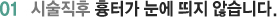 01 시술직후 흉터가 눈에 띄지 않습니다.