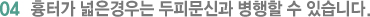 04 흉터가 넓은경우는 두피문신과 병행할 수 있습니다.